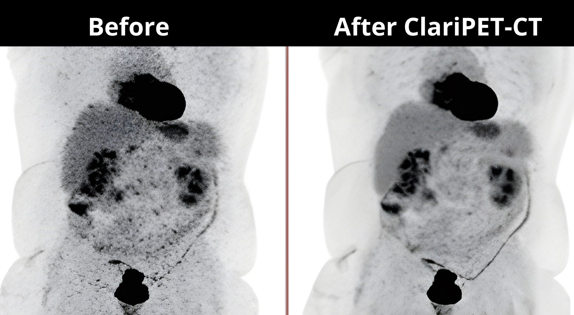 Interface ClariPET - Software para acelerar produtividade em PET-CT