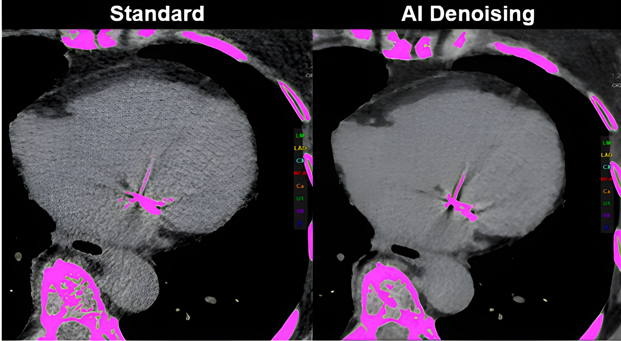 Interface ClariCT.AI - Software para reduzir ruído em tomografia